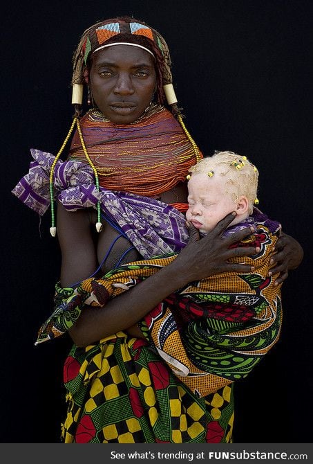 African tribeswoman with her albino baby