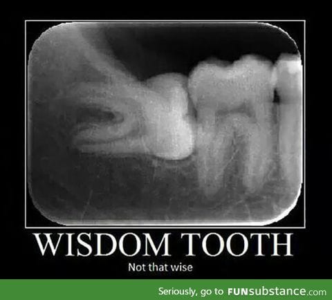 Why do wisdom tooth even exist?
