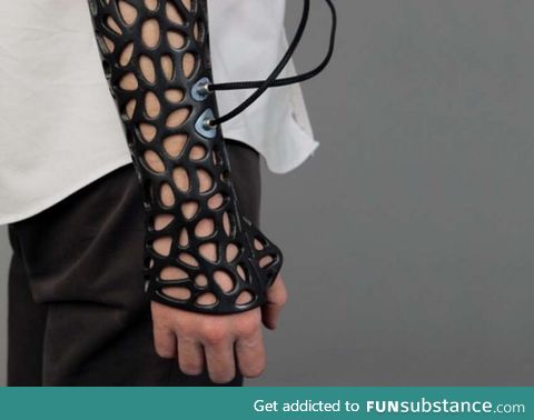 A 3D-printed casts allows broken bones to heal 40% faster than traditional plaster casts