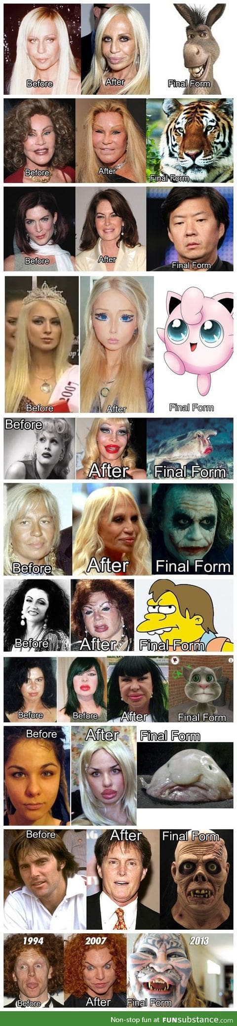 Plastic surgery fail