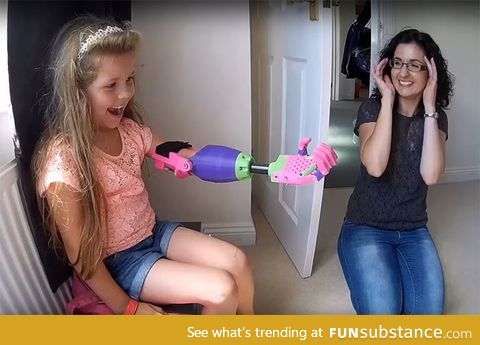 3D printed Prosthetic Arm designed and hand-delivered by Stephen Davies, to an 8 Year old