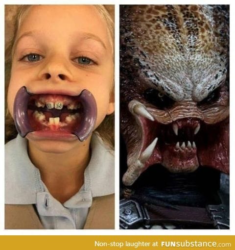 What it looks like when my kid goes to the dentist