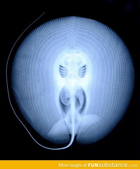 X-Ray of a Stingray