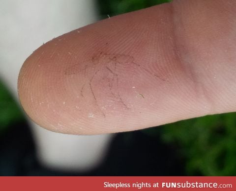 "Slapped a mosquito out of the air and got an imprint of its last moment on my finger"