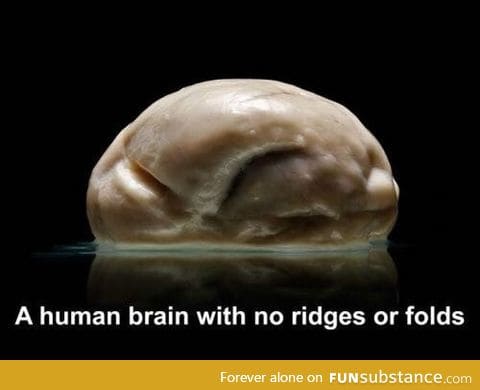 A human brain with no ridges