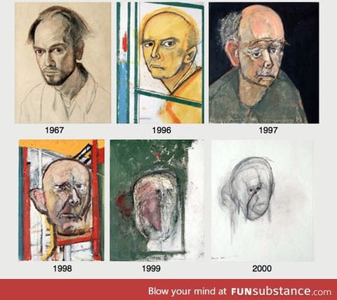 Self-portraits of William Utermohlen, chronicling the progression of his Alzheimer's