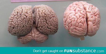 Dolphin brain vs Human brain