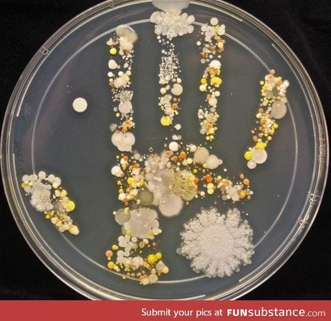 A microbiological culture of an 8-Year old's handprint after playing outside