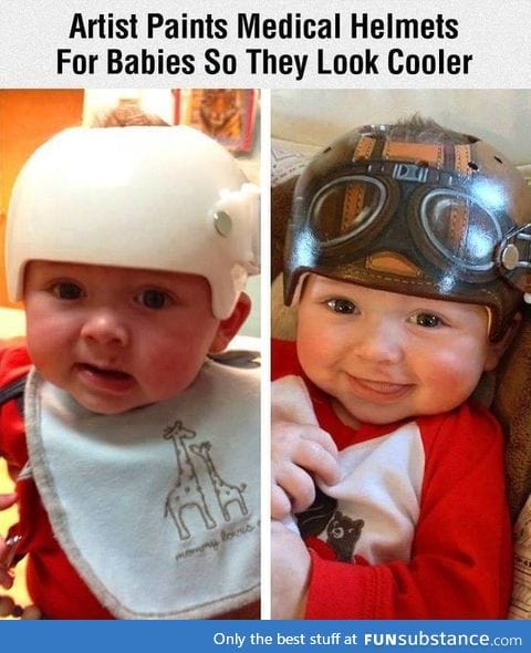 Cool helmet for babies with medical needs