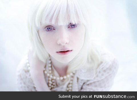 An Albino model: Nastya Zhidkova