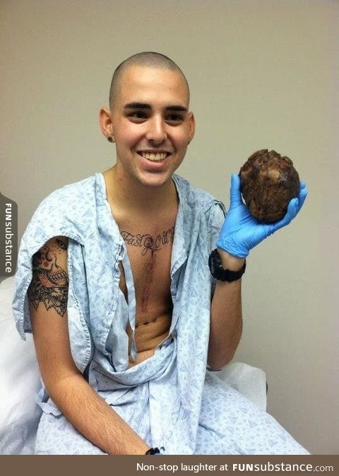 Man holds his own old diseased heart after transplant