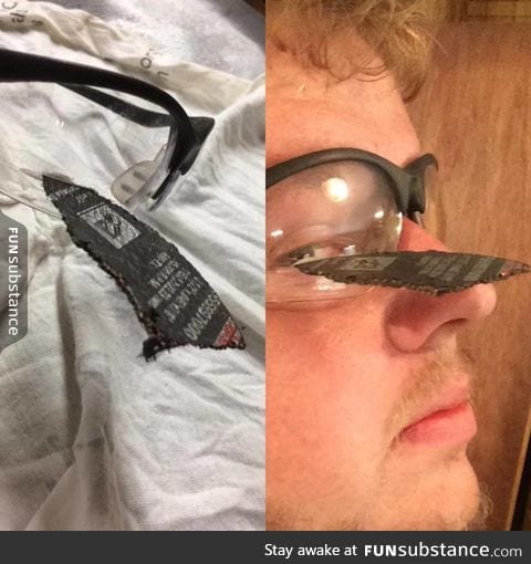 Safety specs saved this guy's eye from an exploding angle grinder disc