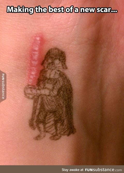 Scar wars, a new hope