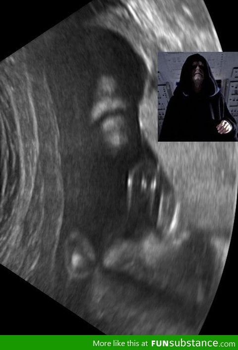 Ultrasound from the dark side of the Force