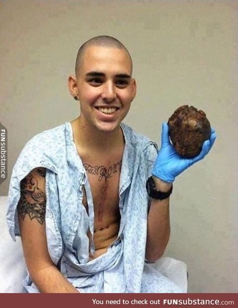 A man holding his old heart following a succesful heart transplant surgery