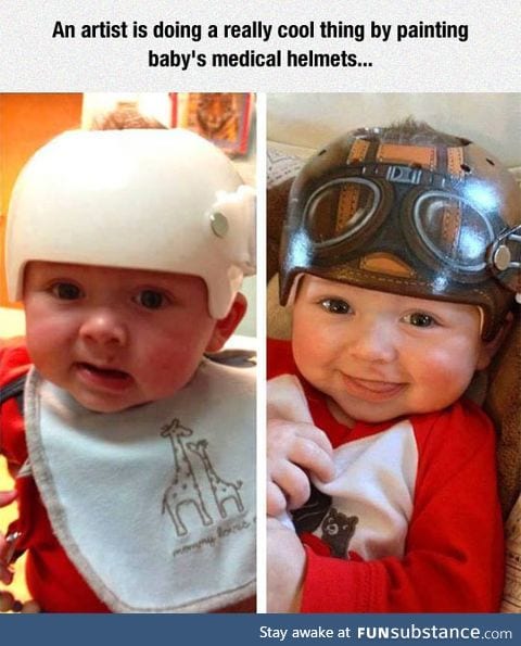 Baby medical helmets