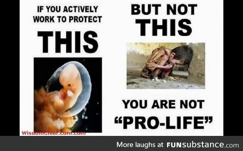 "pro-life" my ass