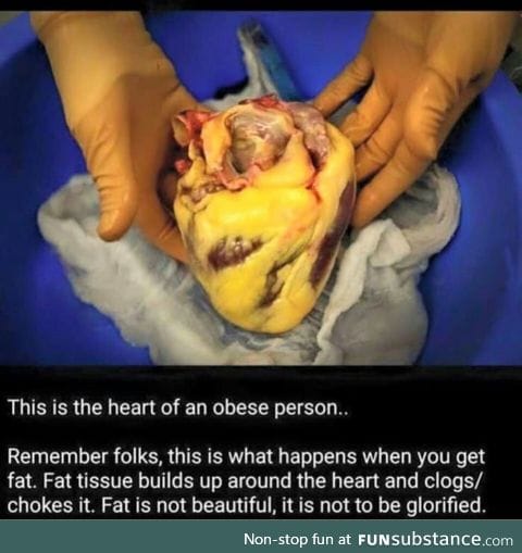 Fat is not to be glorified