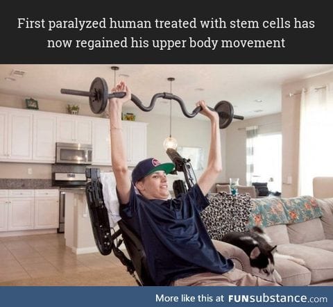 Stem cells showing good results