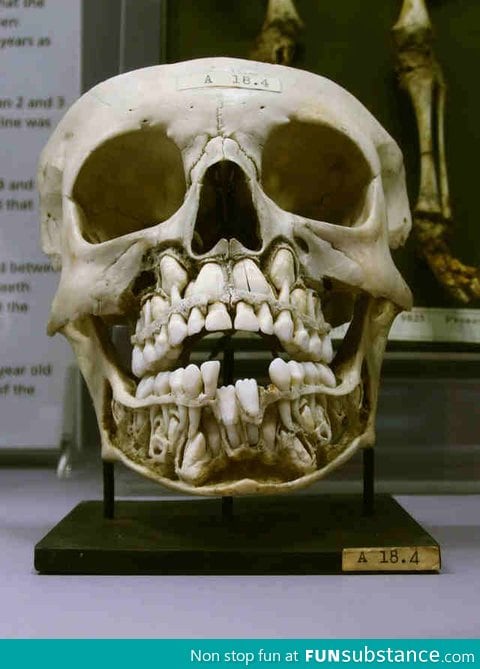 The skull of a child is terrifying with all that teeth