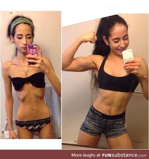 Sarah Ramadan, the girl who overcame anorexia