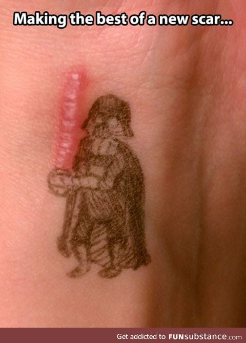 Scar wars, a new hope