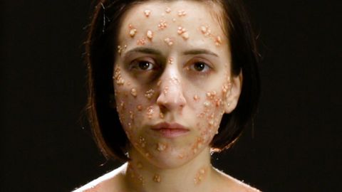 What deadly diseases look like on your body