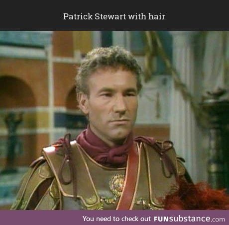 Patrick Stewart with hair
