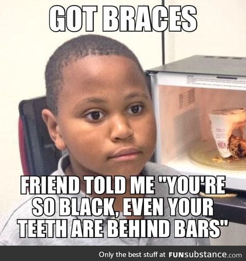 Teeth are behind bars