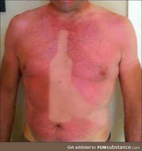 Came back from the beach with a bit of a sunburn