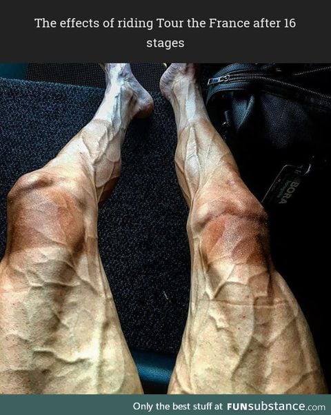 This is what Tour the France rider legs look like after 16 stages