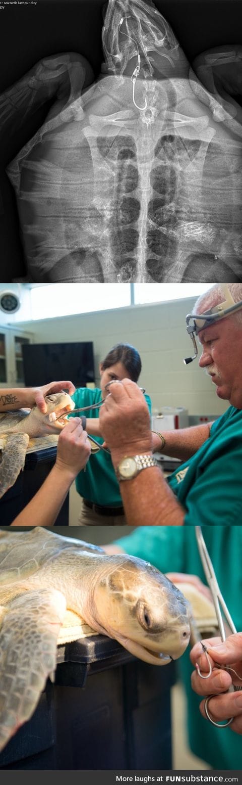 Veterinarians at Houston Zoo remove a fishing hook from a sea turtles mouth