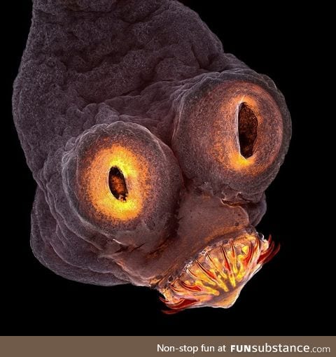 A micrograph of the head of a pork tapeworm
