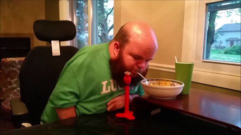 Guy designed and 3D printed this device to help feed himself