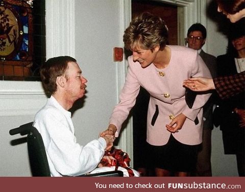 Princess Diana shakes hands with an AIDS patient without gloves, 1991