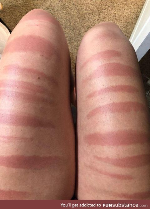 Legs after a day in the sun in ripped jeans