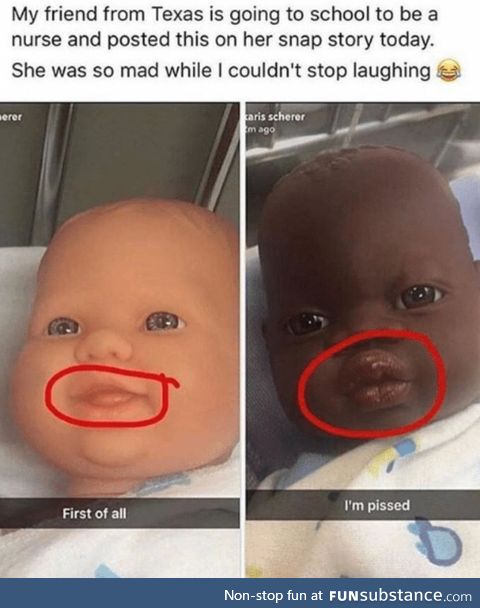 Lip difference