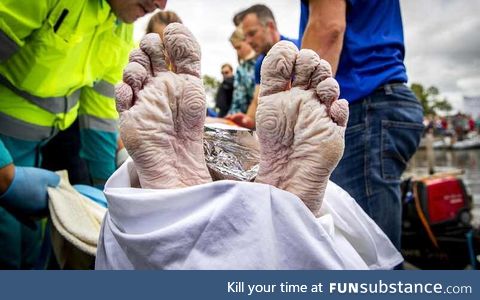 Feet from Dutch olympic swimming champion and cancer survivor Maarten van der Weijden