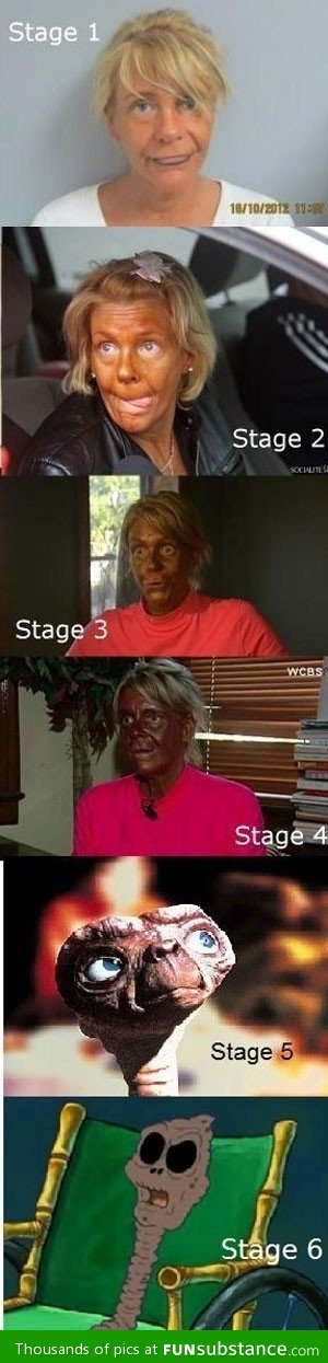 The stages of tanning