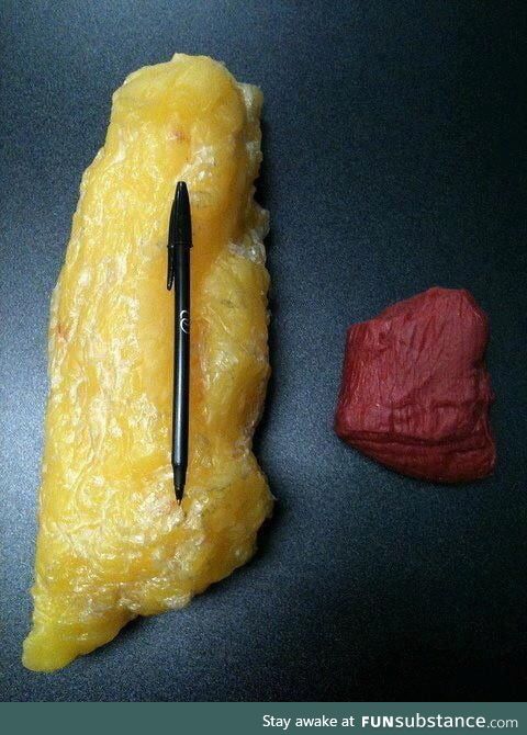 The difference between 1 kg fat and 1 kg muscle