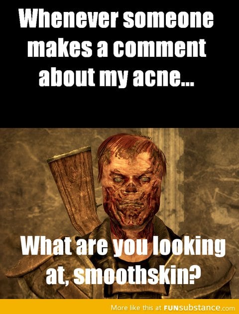 Acne sucks