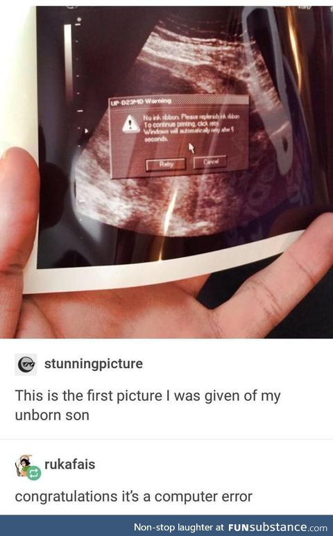Printed the ultrasound, boss