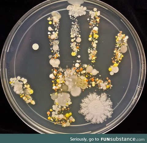 An 8 year old's microbiological handprint after playing outside