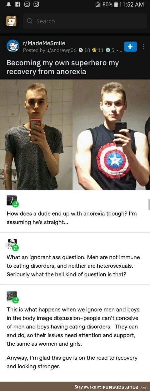 Apparently straight guys can't get anorexia