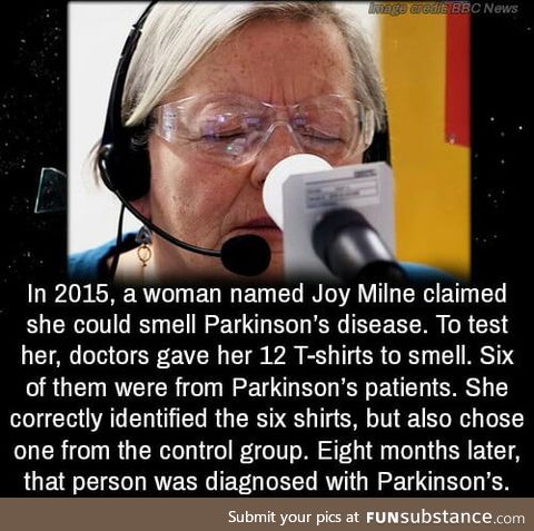 Woman with the ability to smell Parkinson's, it's a medical mystery