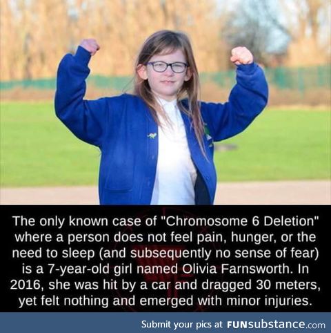 Only known case of Chromosome 6 Deletion