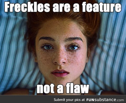 Freckles are pretty