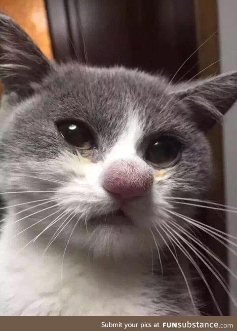Lost a fight with a bee resulting in a derpy clown nose