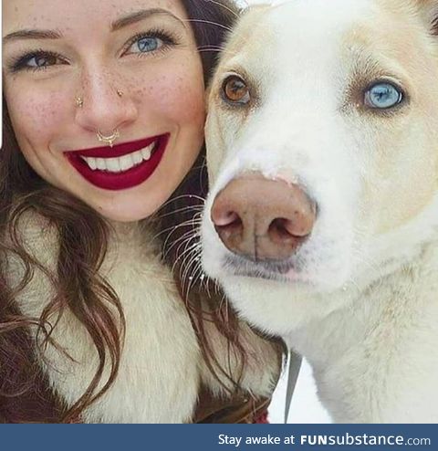 An interesting example of a human and a dog with heterochromia