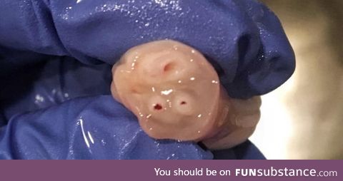 TIL: The umbilical cord has one vein that feeds babies with the nutrients they need from